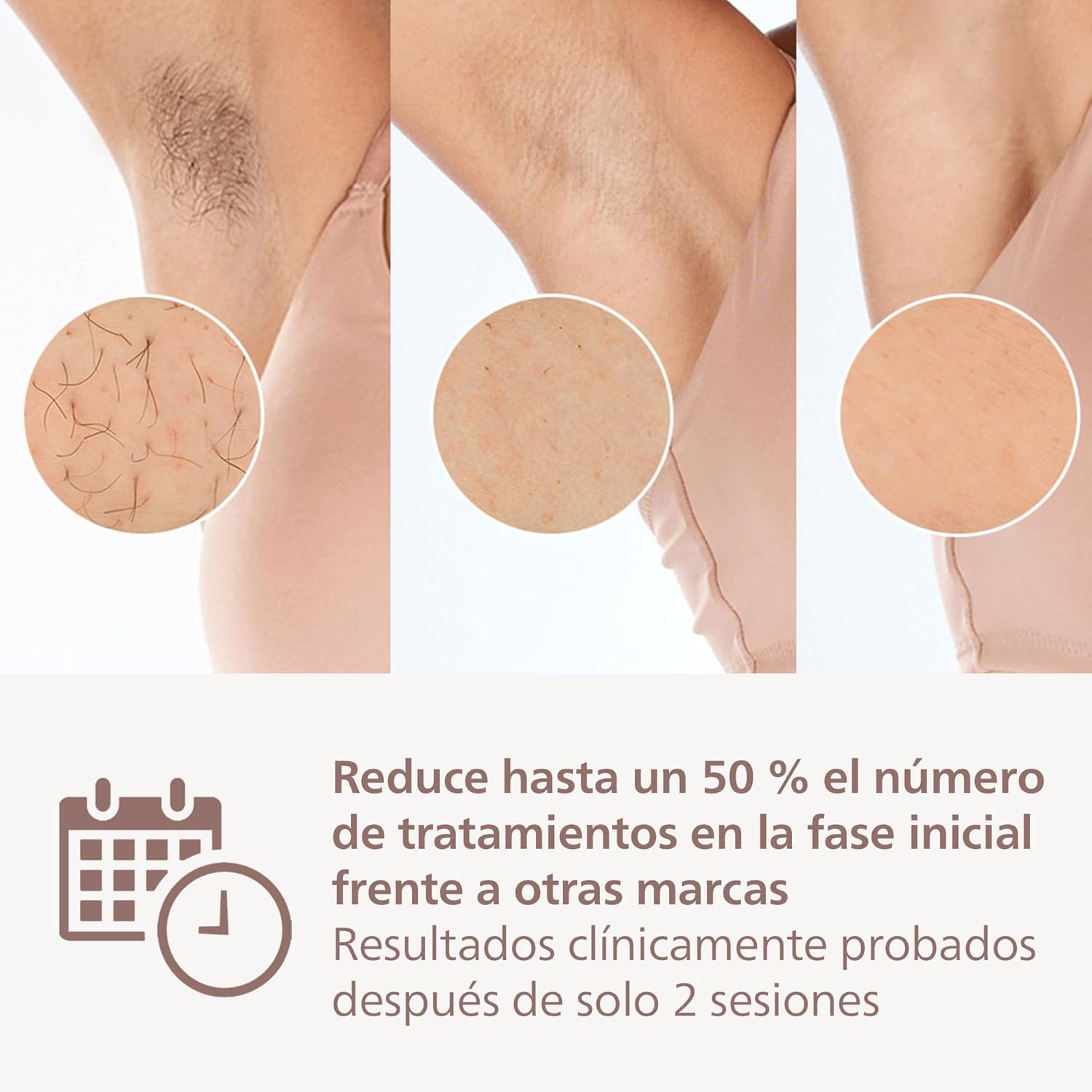 Philips Lumea serie 9900, dispositivo de depilación IPL, alternativa de depilación láser, SenseIQ y SkinAI, 3 accesorios para el cuerpo, la cara y zonas de precisión, con y sin cable, BRI953/02 - 4